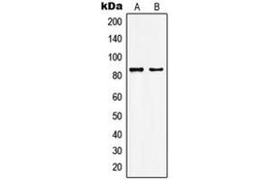 Western blot analysis of KAT7 expression in HepG2 (A), MCF7 (B) whole cell lysates. (MYST2 抗体  (Center))