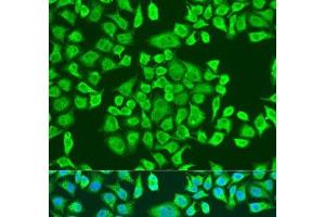 Immunofluorescence analysis of U2OS cells using IGF2BP3 Polyclonal Antibody at dilution of 1:100. (IGF2BP3 抗体)