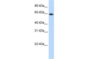 Western Blotting (WB) image for anti-RING Finger Protein 6 (RNF6) antibody (ABIN2461523) (RNF6 抗体)