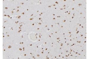 ABIN6276644 at 1/100 staining Human brain tissue by IHC-P. (PSMA3 抗体  (Internal Region))