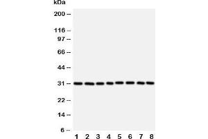 Western blot testing of VDAC1 antibody and Lane 1:  rat skeletal muscle;  2: (r) heart;  3: (r) liver; and human samples 4: HeLa;  5: A431;  6: A549;  7: SMMC-7721;  8: HT1080 cell lysate. (VDAC1 抗体  (Middle Region))