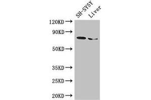 Western Blot Positive WB detected in: SH-SY5Y whole cell lysate, Mouse liver tissue All lanes: CHAT antibody at 3 μg/mL Secondary Goat polyclonal to rabbit IgG at 1/50000 dilution Predicted band size: 83, 75, 71 kDa Observed band size: 75 kDa (Choline Acetyltransferase 抗体  (AA 354-592))
