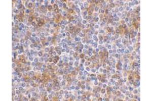 Immunohistochemical staining of human spleen using AP30069PU-N APOBEC3G antibody at 1 μg/ml. (APOBEC3G 抗体  (N-Term))