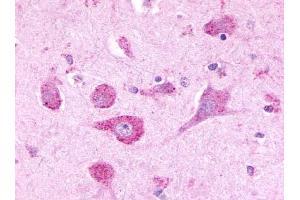 Immunohistochemical staining of Brain (Neurons) using anti- LPHN3 antibody ABIN122280 (LPHN3 抗体  (Cytoplasmic Domain))