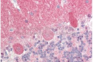 Rabbit Anti-PPP3CA antibody  Formalin Fixed Paraffin Embedded Tissue: Human Adult Brain, cerebellum  Observed Staining: Cytoplasm in hepatocytes Primary Antibody Concentration: 1:600 Secondary Antibody: Donkey anti-Rabbit-Cy3 Secondary Antibody Concentration: 1:200 Magnification: 20X Exposure Time: 0.