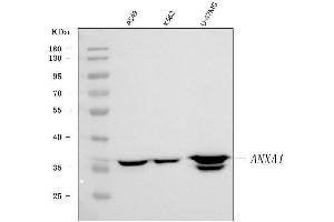 Western blot analysis of Annexin A1/ANXA1 using anti-Annexin A1/ANXA1 antibody (ABIN7600491).