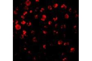 Immunofluorescence of IRAK2 in HeLa cells with AP30441PU-N IRAK antibody at 10 μg/ml. (IRAK2 抗体  (C-Term))