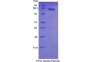 SDS-PAGE of Protein Standard from the Kit  (Highly purified E. (TNNC2 ELISA 试剂盒)