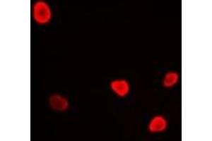 Immunofluorescent analysis of RFC4 staining in U2OS cells. (RFC4 抗体)