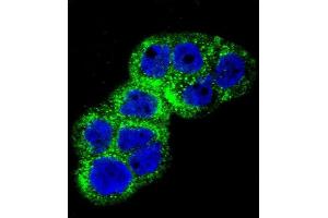 Confocal immunofluorescent analysis of IGF1R Antibody (N-term K66) (ABIN652374 and ABIN2841778) with WiDr cell followed by Alexa Fluor 488-conjugated goat anti-rabbit lgG (green). (IGF1R 抗体  (N-Term))