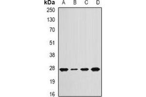 Western blot analysis of APC10 expression in Jurkat (A), mouse lung (B), mouse spleen (C), rat heart (D) whole cell lysates. (ANAPC10 抗体)