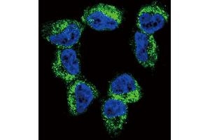 Confocal immunofluorescent analysis of BDNF Antibody (C-term) (ABIN392515 and ABIN2842076) with NCI- cell followed by Alexa Fluor 488-conjugated goat anti-rabbit lgG (green). (BDNF 抗体  (C-Term))