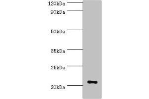 Western blot All lanes: ARF3 antibody at 6 μg/mL + Mouse brain tissue Secondary Goat polyclonal to rabbit IgG at 1/10000 dilution Predicted band size: 21, 17 kDa Observed band size: 21 kDa (ARF3 抗体  (AA 1-181))
