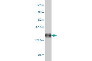 Western Blot detection against Immunogen (36. (RPRD1A 抗体  (AA 76-170))