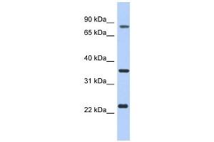 C17ORF82 antibody used at 1 ug/ml to detect target protein. (C17orf82 抗体  (N-Term))