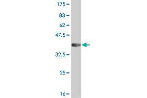 Western Blot detection against Immunogen (36. (IRAK2 抗体  (AA 111-210))