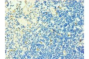 Immunohistochemistry of paraffin-embedded human thymus tissue using ABIN7173325 at dilution of 1:100 (TCOF1 抗体  (AA 1189-1488))