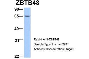 Human 293T; Host: Rabbit . (ZBTB48 抗体  (N-Term))