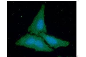 anti-Creatine Kinase, Brain (CKB) (AA 1-381) antibody