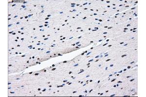 Immunohistochemical staining of paraffin-embedded endometrium tissue using anti-HDAC10mouse monoclonal antibody. (HDAC10 抗体)