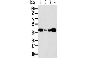 Gel: 12 % SDS-PAGE, Lysate: 40 μg, Lane 1-4: Human testis tissue, Human seminoma tissue, Jurkat cells, human liver cancer tissue, Primary antibody: ABIN7192710(SYCP3 Antibody) at dilution 1/200, Secondary antibody: Goat anti rabbit IgG at 1/8000 dilution, Exposure time: 40 seconds (SYCP3 抗体)