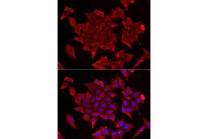 Immunofluorescence analysis of U2OS cells using TIMM17A antibody. (TIMM17A 抗体)