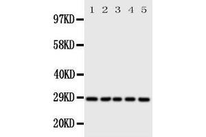 Western Blotting (WB) image for anti-Stratifin (SFN) (AA 140-156), (Middle Region) antibody (ABIN3044182) (14-3-3 sigma/SFN 抗体  (Middle Region))