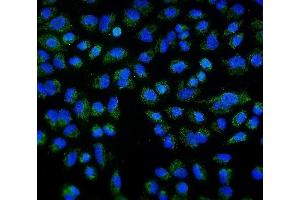 IF analysis of DLL1 using anti-DLL1 antibody (ABIN7600324). (DLL1 抗体  (AA 18-239))