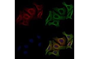 ABIN6256614 and ABIN6267490 staining HepG2 cells(4h of LPS treatment) by IF/ICC. (VEGFR2/CD309 抗体  (pTyr1059))