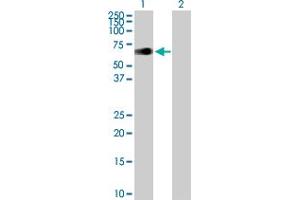 Western Blot analysis of ZIM2 expression in transfected 293T cell line by ZIM2 MaxPab polyclonal antibody. (ZIM2 抗体  (AA 1-527))