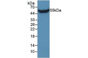 Detection of Recombinant STC1, Human using Monoclonal Antibody to Stanniocalcin 1 (STC1) (Stanniocalcin 1 抗体  (AA 28-247))