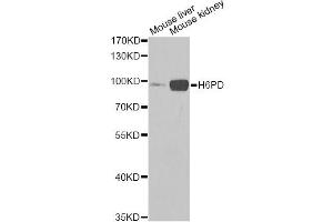 Western blot analysis of extracts of various cell lines, using H6PD Antibody. (Glucose-6-Phosphate Dehydrogenase 抗体)
