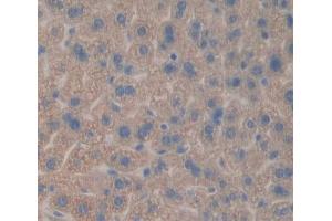 IHC-P analysis of liver tissue, with DAB staining. (CES1 抗体  (AA 31-286))