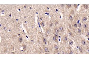 Detection of CSNK1d in Human Cerebrum Tissue using Monoclonal Antibody to Casein Kinase 1 Delta (CSNK1d) (Casein Kinase 1 delta 抗体  (AA 1-409))