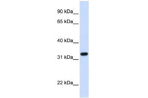 WB Suggested Anti-TBCB Antibody Titration: 0. (TBCB 抗体  (C-Term))