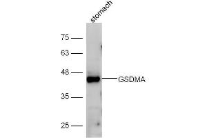 Western Blotting (WB) image for anti-Gasdermin A (GSDMA) (AA 21-120) antibody (ABIN2559502)