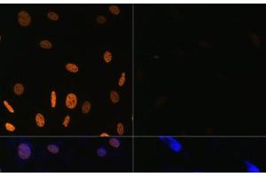 Immunofluorescence (IF) image for anti-Histone 3 (H3) (acLys14), (acLys18), (acLys23), (acLys27), (acLys9) antibody (ABIN7259751)