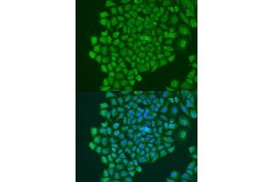 Western blot analysis of extracts of HepG2 cells, using YB-1/YB-1/YBX1 antibody (ABIN7271411) at 1:1000 dilution. (YBX1 抗体  (AA 100-200))