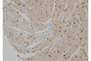 ABIN6277018 at 1/100 staining Mouse heart tissue by IHC-P. (MT2A 抗体)