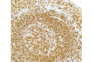 Immunohistochemistry (IHC) image for anti-MHC Class II HLA-DP/DQ/DR (HLA-DP/DQ/DR) antibody (ABIN7449429) (MHC Class II HLA-DP/DQ/DR 抗体)