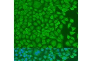 Immunofluorescence analysis of U2OS cells using PCBP1 Polyclonal Antibody at dilution of 1:100. (PCBP1 抗体)
