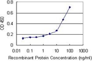 Detection limit for recombinant GST tagged UBR1 is 0. (UBR1 抗体  (AA 2-100))