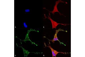 Immunocytochemistry (ICC) image for anti-Calcium Channel, Voltage-Dependent, beta 2 Subunit (CACNB2) (AA 189-205) antibody (Atto 594) (ABIN2485031)