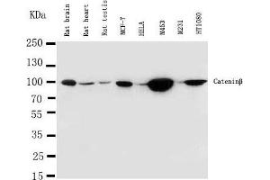Lane 8:  Cell Lysate (CTNNB1 抗体  (C-Term))