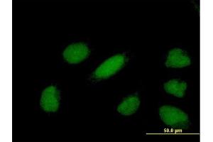 Immunofluorescence of purified MaxPab antibody to YEATS4 on HeLa cell. (GAS41 抗体  (AA 1-227))