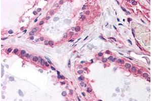 Human Thyroid: Formalin-Fixed, Paraffin-Embedded (FFPE) (MCF2L 抗体  (AA 220-320))