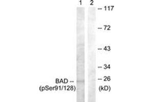 Western blot analysis of extracts from COS7 cells treated with TNF-a 20ng/ml+Calyculin A 50nM 5', using BAD (Phospho-Ser91/128) Antibody. (BAD 抗体  (pSer91))