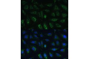 Immunofluorescence analysis of U-2 OS cells using R Polyclonal Antibody (ABIN7269849) at dilution of 1:100 (40x lens). (GRF2 抗体  (AA 844-1095))