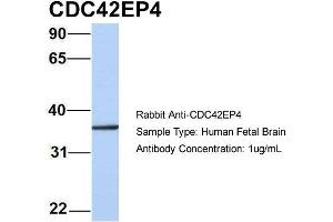 Host: Rabbit Target Name: CDC42EP4 Sample Type: Human Fetal Brain Antibody Dilution: 1.