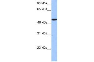 WB Suggested Anti-REXO4 Antibody Titration:  0. (REXO4 抗体  (Middle Region))